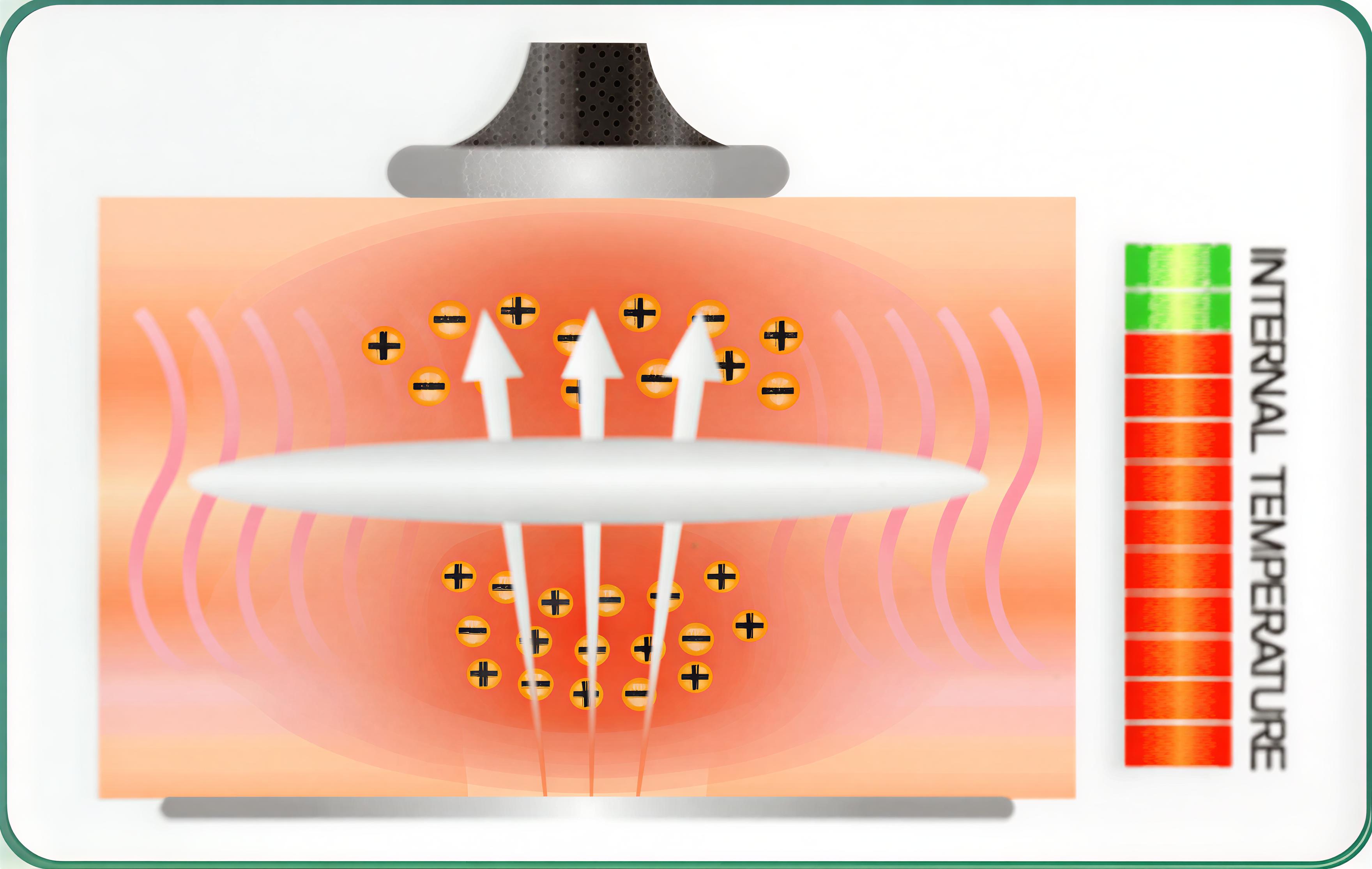 RET Technology Diagram